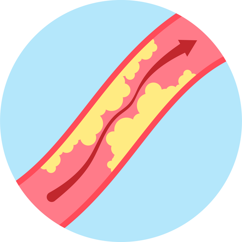 Blocked High thigh calf vascular pain limb ischemia